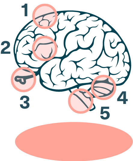 Brain with multiple highlighted tumor locations and associated symptoms